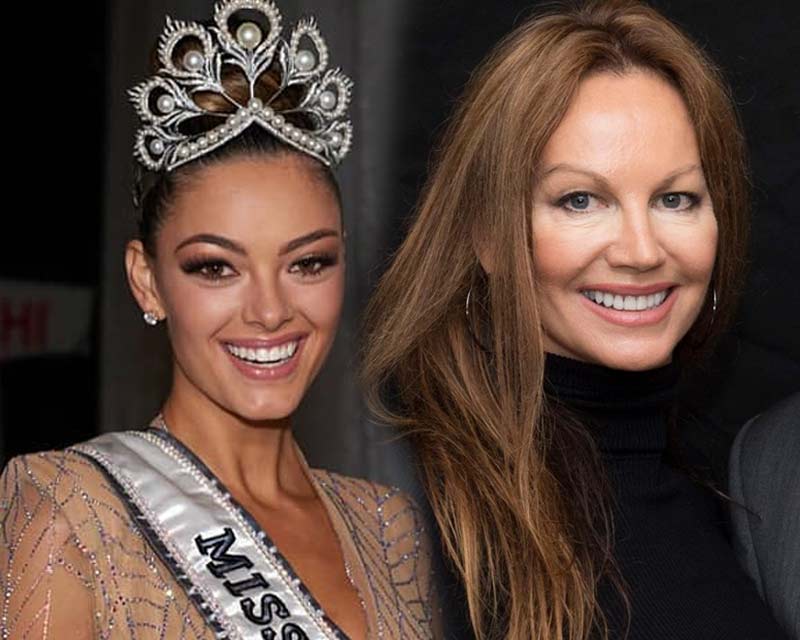 Demi Leigh Nel Peters Invited to The Golden Globes by Margaret Gardiner