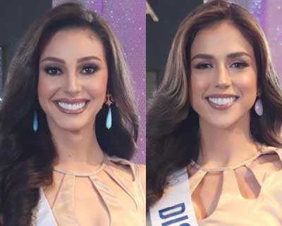 Miss Venezuela 2022 Top 5 Hot Picks