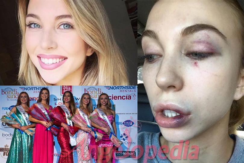 Elise Chambellant attacked by four women in random nightclub