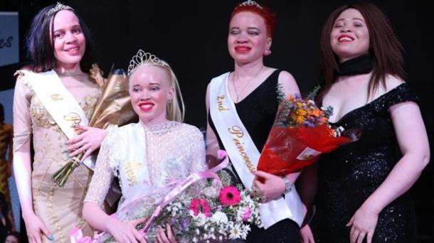 A Look into the World of Albino Beauty Pageants