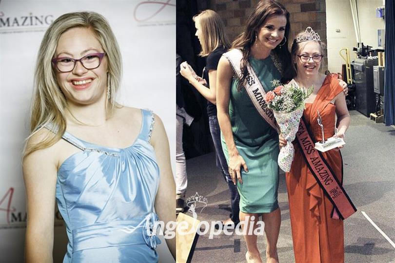 Woman with Down syndrome all set to compete in Miss Minnesota USA beauty Pageant