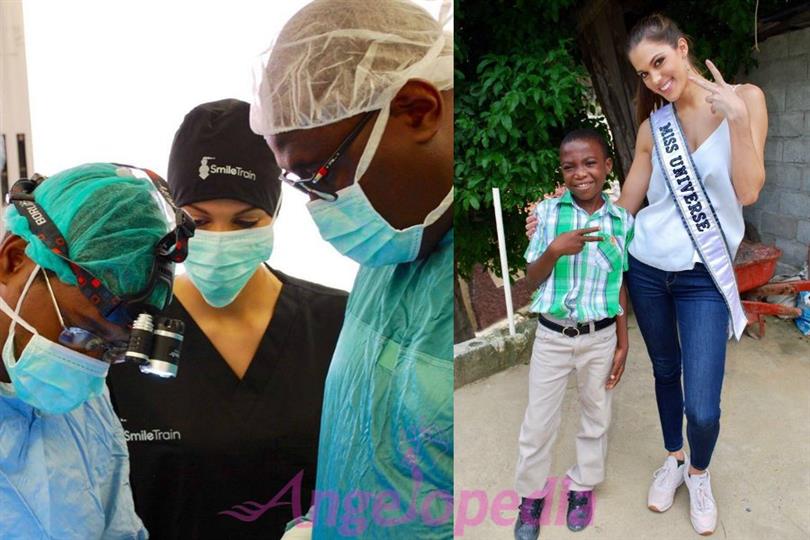 Iris Mittenaere witnesses cleft surgery at Hopital Universitaire Justinien in Cap Haitien