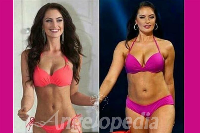Siera Bearchell receives positive feedback on her stance against body shaming